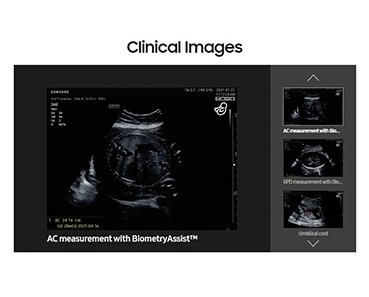 Samsung Ultrasound  HM 70 EVO