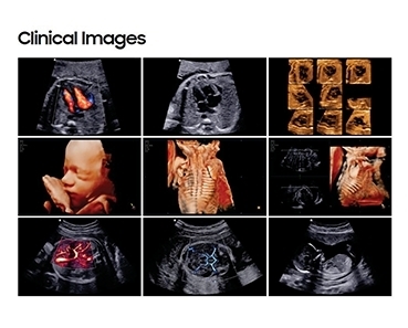 Samsung Ultrasound  HERA W10、HERA W9