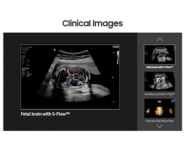 Samsung Ultrasound  HS 60、HS 40、HS 30