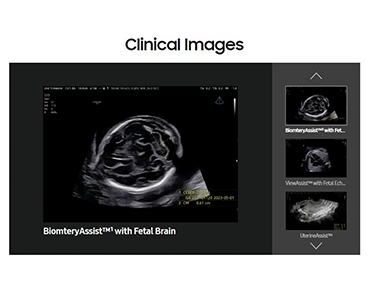 Samsung Ultrasound  V8