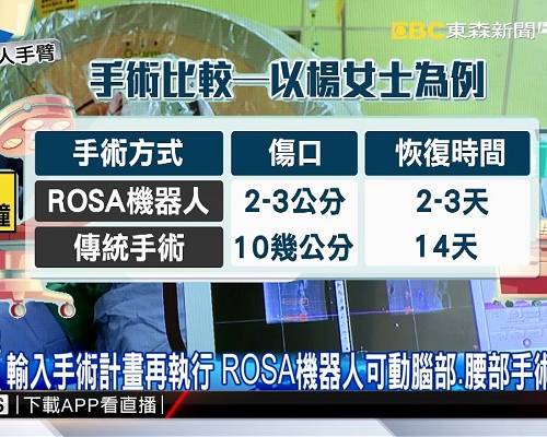 【UHG醫療新聞】ROSA機器人手臂開脊椎手術 縮短下床時間
