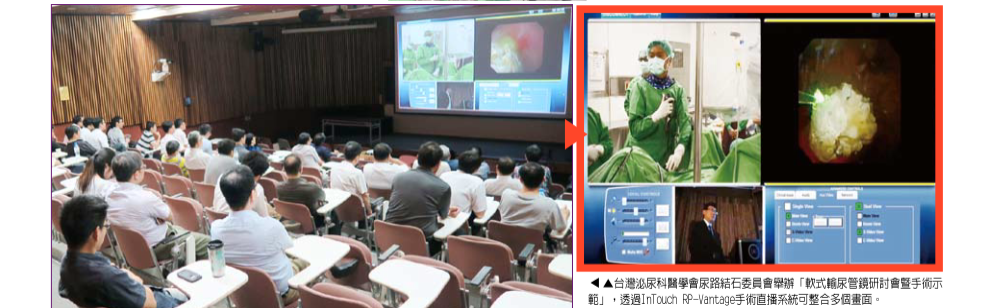 【新聞報導】手術實境秀 快速掌握新術式