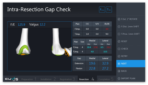 Cuvis Joint