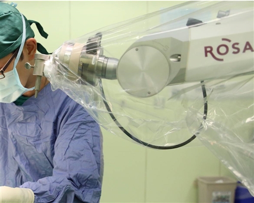 ROSA勵羅莎手術機器人，癲癇手術精準定位新選擇