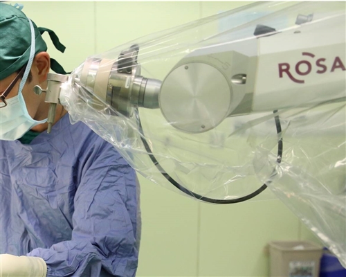 ROSA One, the New Choice for Precise Positioning in Epilepsy Surgery