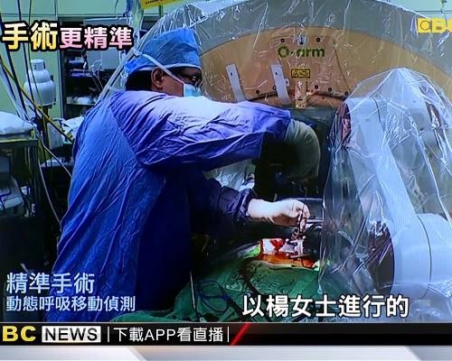 【東森新聞】脊椎釘骨釘隔天能下床 ROSA機器人助精準動刀