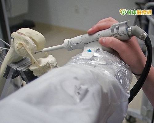 【新聞報導】換膝手術革命　機器手臂提升精準度