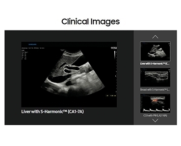 Samsung Ultrasound  RS85 Prestige 、RS80 EVO