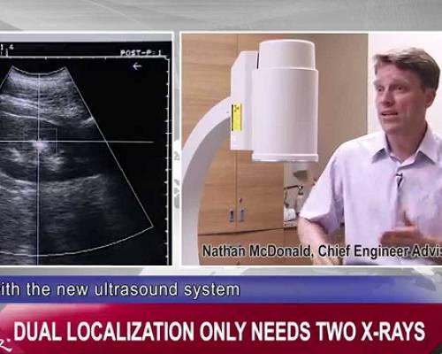 The First Auto Tracking & Locking ESWL (Lithotripsy) in The World