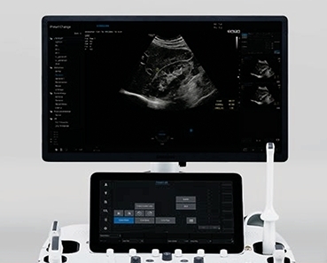 Samsung Ultrasound  RS85 Prestige 、RS80 EVO